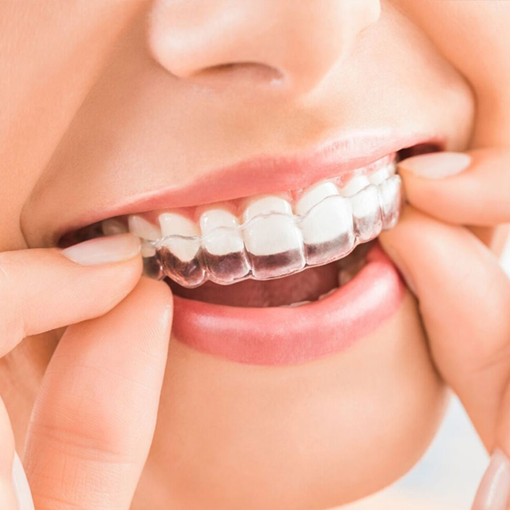 cum să tratăm dinții cu artrita